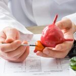 ۲۰ راهکار پیشگیری از سرطان پروستات