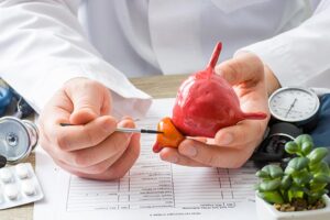 ۲۰ راهکار پیشگیری از سرطان پروستات